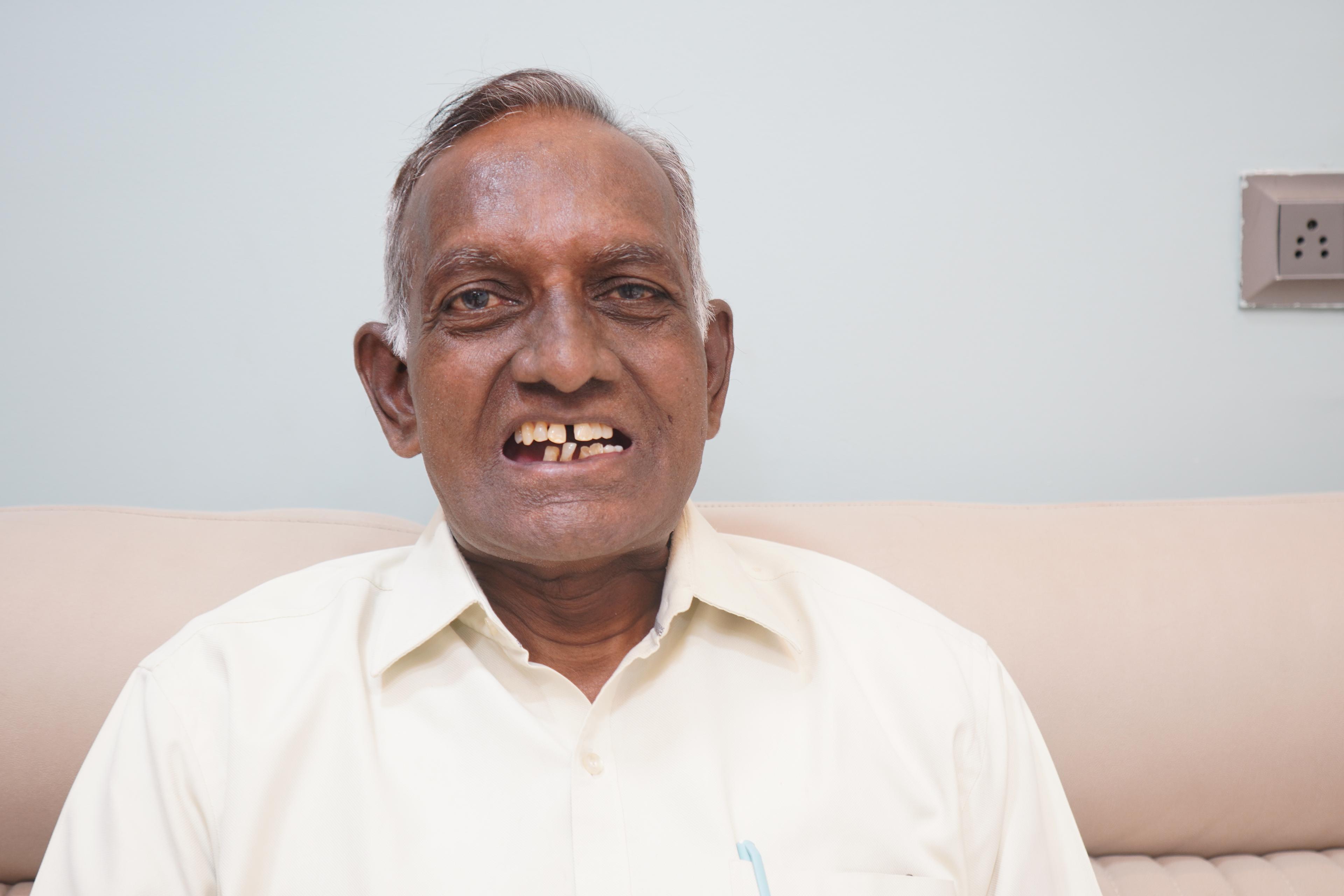 Arun Wasu before treatment photo 1