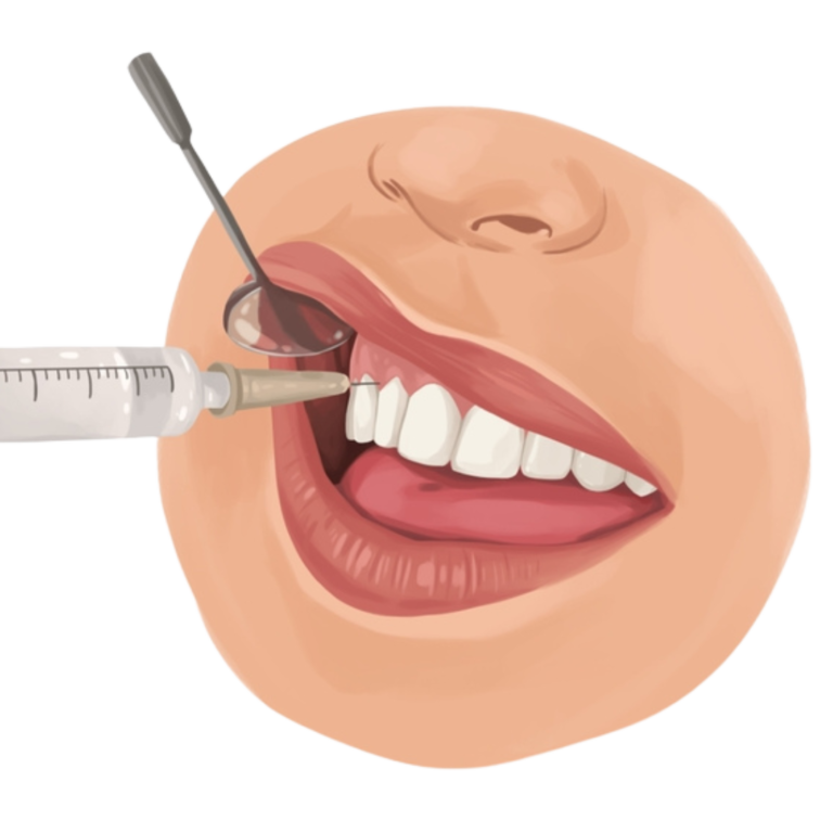 dental anesthesia