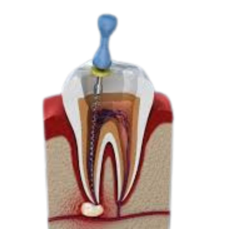 dental tooth pulp