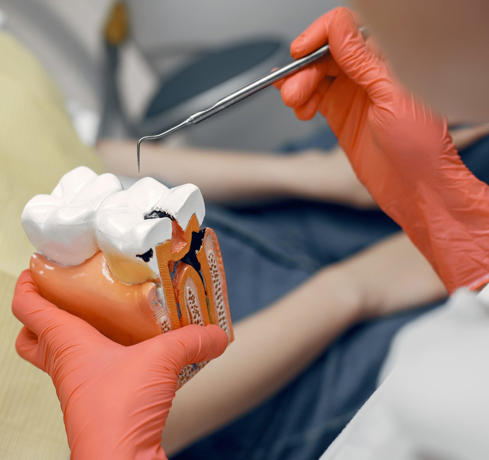 Best Root Canal Treatment in Pune- Urban Smile Dental Clinic