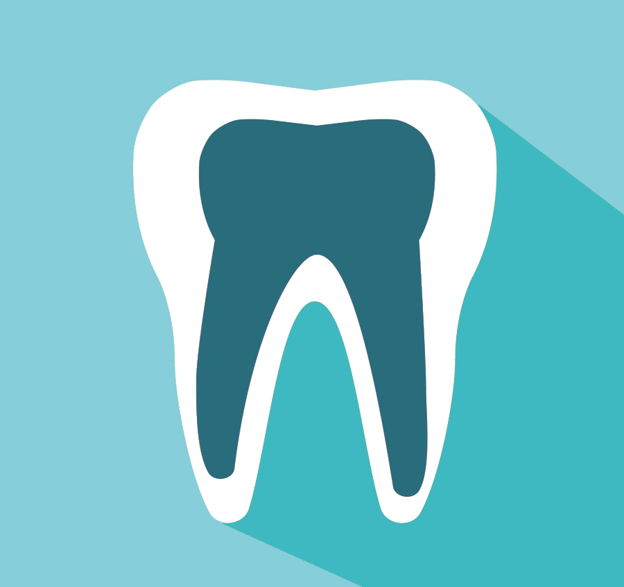 Root Canal Treatment (rct)