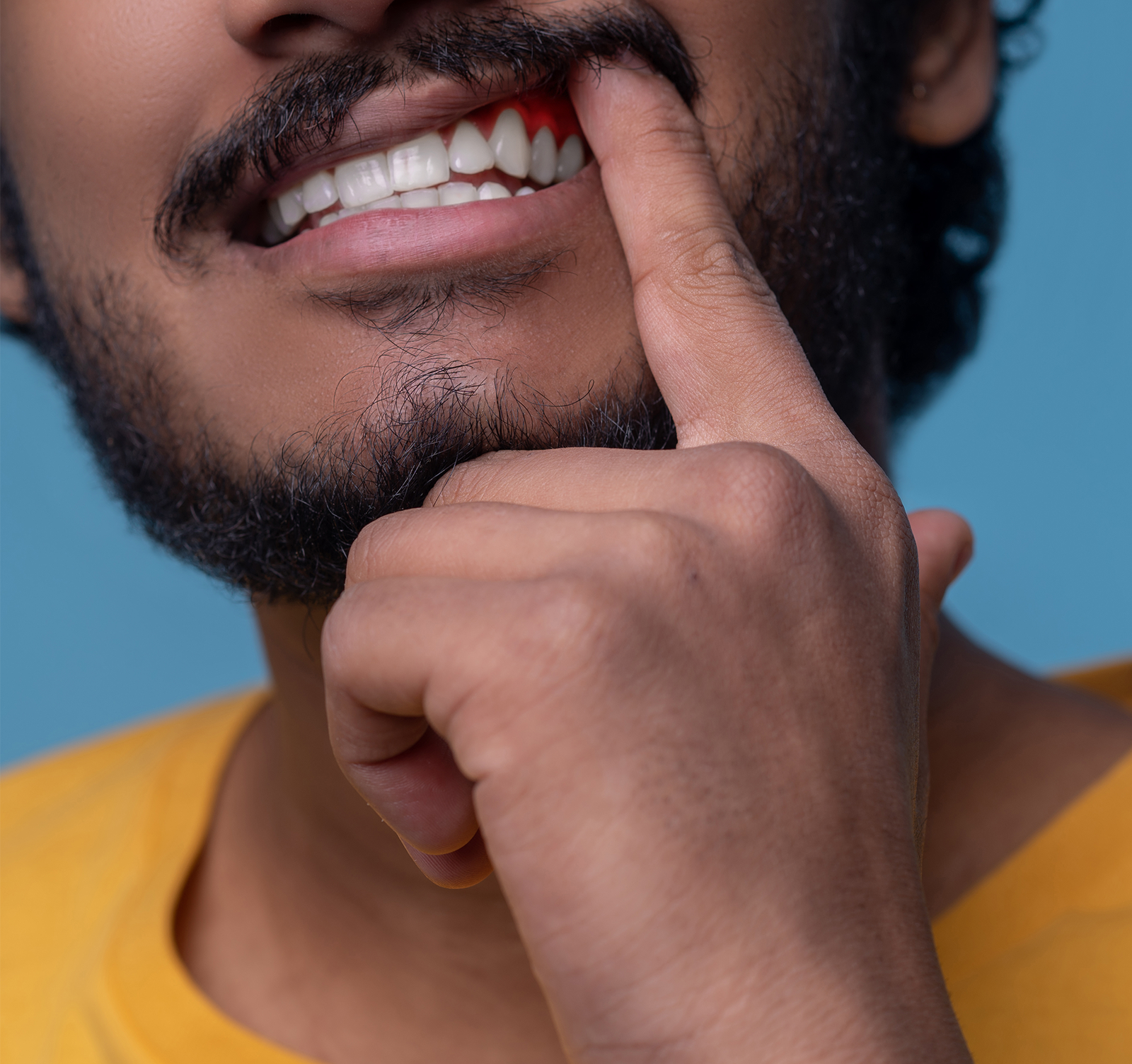 Urban Smile Dental Clinic - Tooth Whitening
