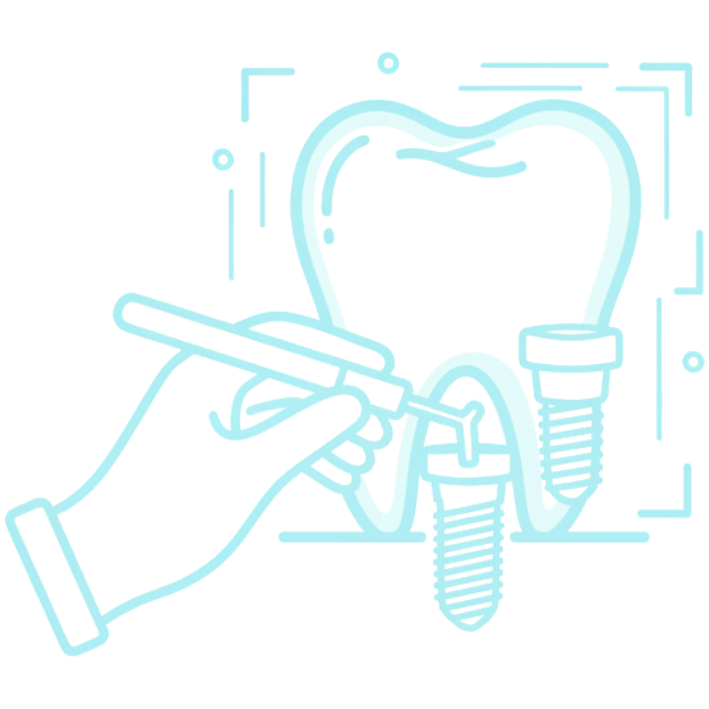 Specialised Implant Expertise